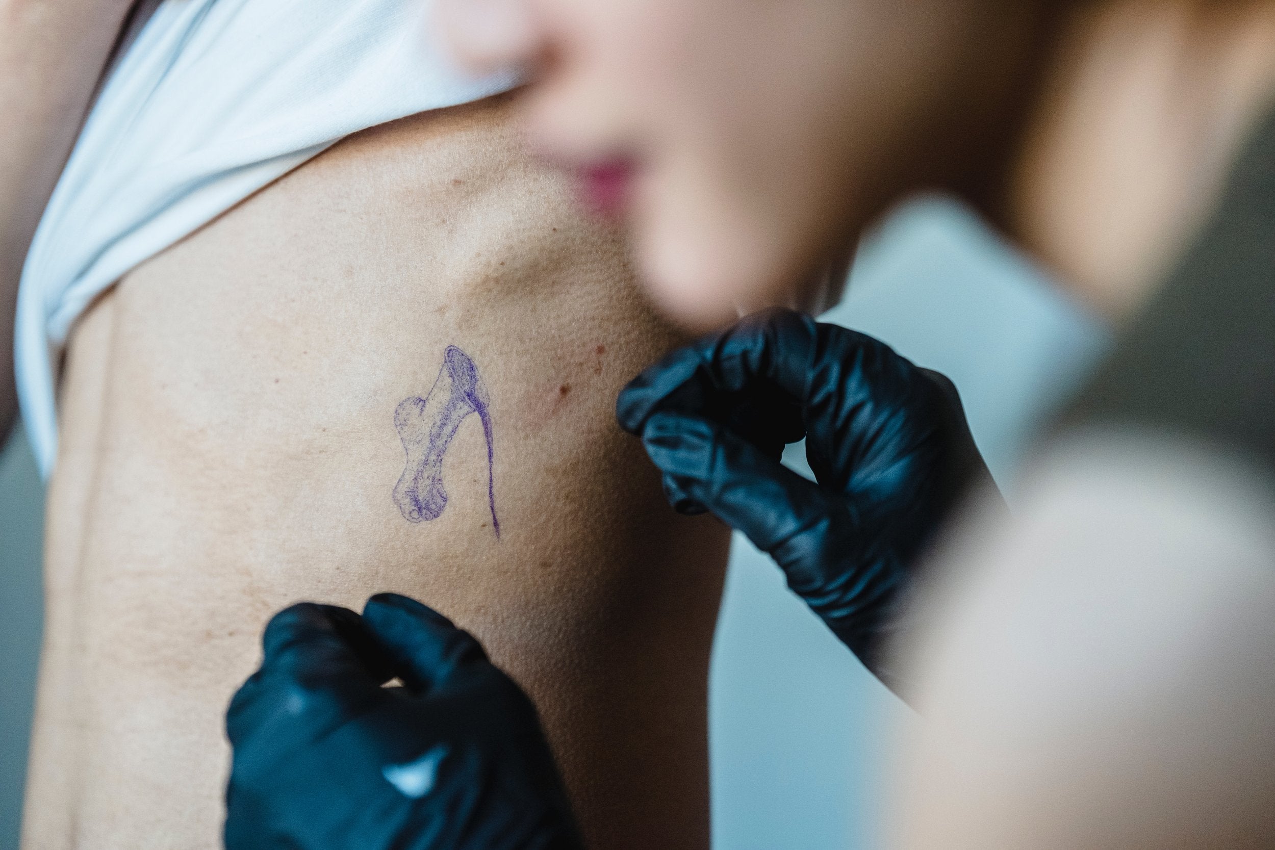 How To Get Stained Tattoo Ink Off Skin